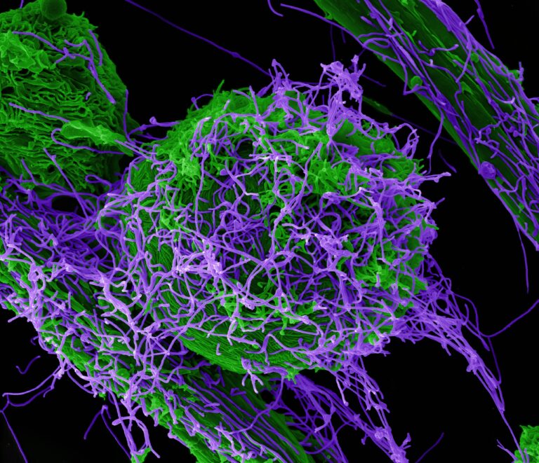 Une souche inconnue — Virus ebola